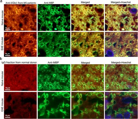 A Higher Magnification Of The White Matter Taken From The Different