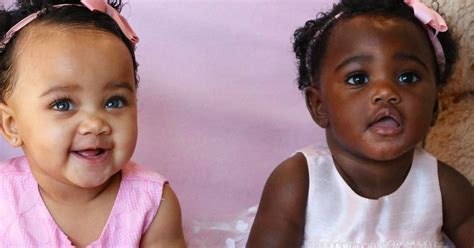 mom shares photos of her twins with different skin colors thousands comment online