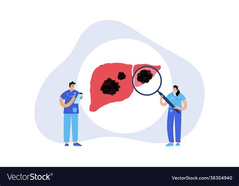 Liver Disease Concept Royalty Free Vector Image