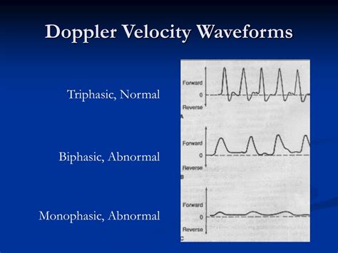 Ppt Continuous Wave Doppler Device Powerpoint Presentation Free