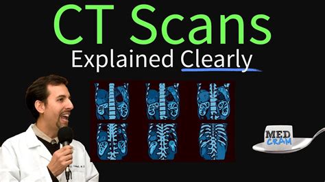 Ct Scan Of The Chest Explained Clearly High Resolution