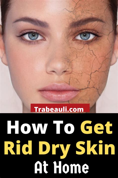 How To Get Rid Of Dry Skin On Face Naturally At Home Artofit