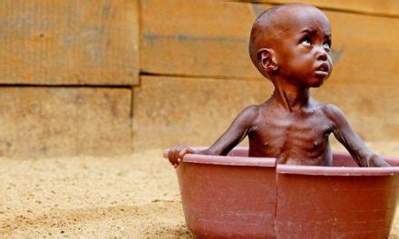 Bagaimana Cara Pengobatan Dan Pencegahan Malnutrisi Kurang Gizi