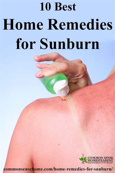 How To Stop Sunburn Itching The Ultimate Guide Ihsanpedia