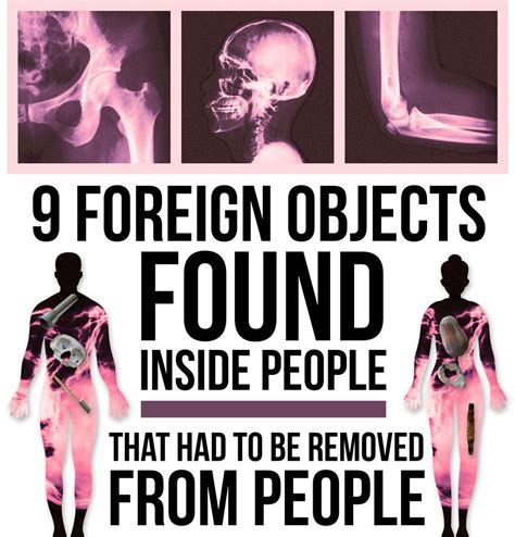 9 things people put inside their bodies that had to be removed from their bodies how to remove