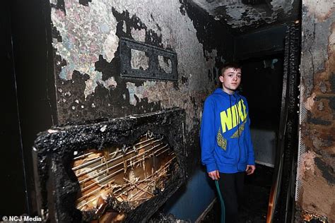 Boy 16 Tells Of Terrifying Moment He Woke To Find His Bed On Fire