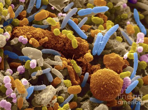 Human Feces Containing Bacteria Photograph By Scimat Pixels