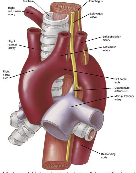 Aortic Arch Anatomy Variants