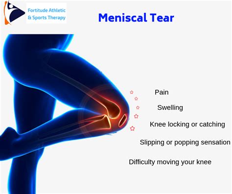 Meniscus Tears Are Among The Most Common Knee Injuries Athletes