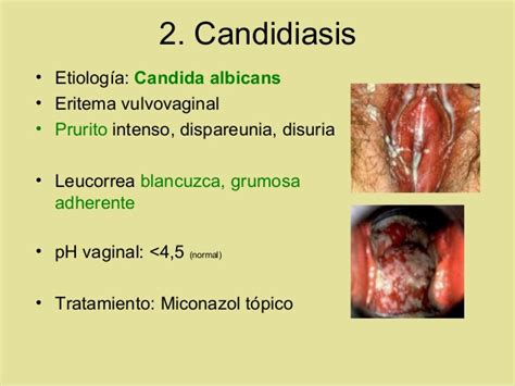 Romantic and sensual vaginal massage. Vulvovaginitis - Pictures