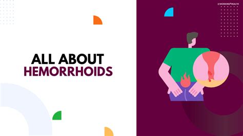 hemorrhoids causes types symptoms and more working for health