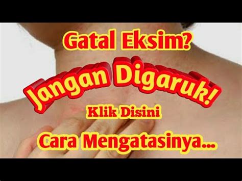 Kudis adalah penyakit kulit yang disebabkan oleh parasit tungau yakni sarcoptes scabiei var hominis. EKSIM KULIT ! Cara Mengobati Penyakit Kulit Eksim Dengan ...