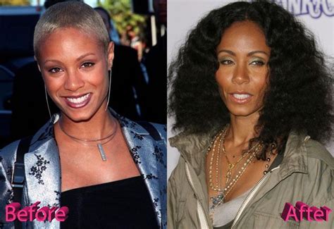 Jada Pinkett Smith Before And After Cosmetic Surgery Plastic Surgery