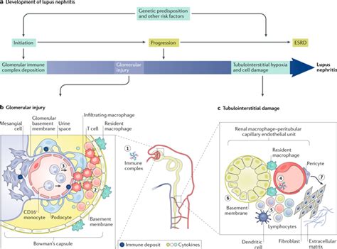 Protecting The Kidney In Systemic Lupus Erythematosus From Diagnosis