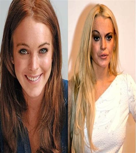60 Worst Cases Of Celebrity Plastic Surgery Gone Wrong 8e9