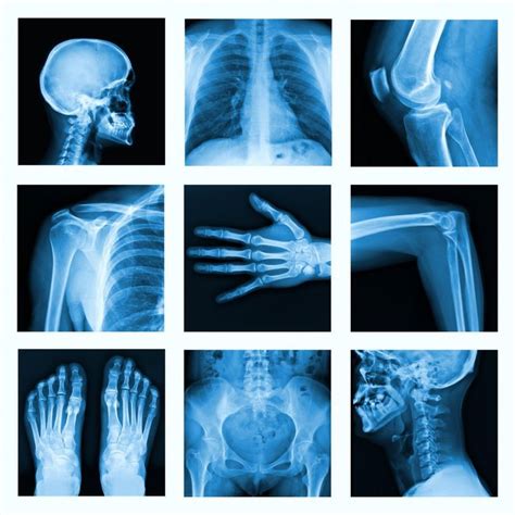 Pinterest X Ray Bones Radiology