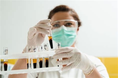 Analyse von blutplasma der laborant hält ein reagenzglas mit blut aus einer vene in den händen