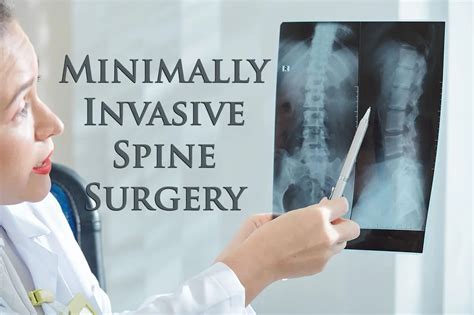 Miss Minimally Invasive Spine Surgery • Chiropractic Scientist