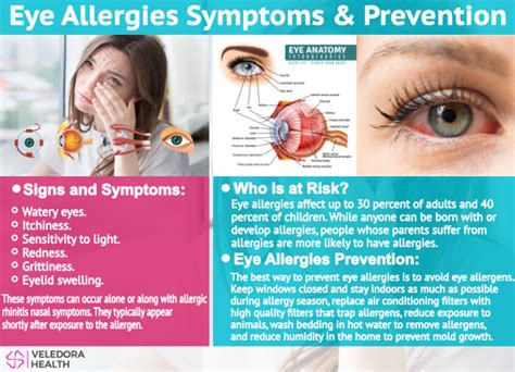 Eye Allergies Treatment Options And Management