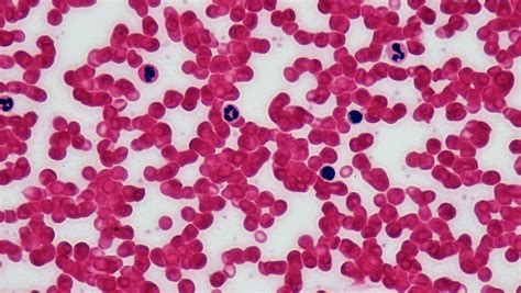 Connective Tissue Human Blood Leukocyte Survey Smear Hum Flickr