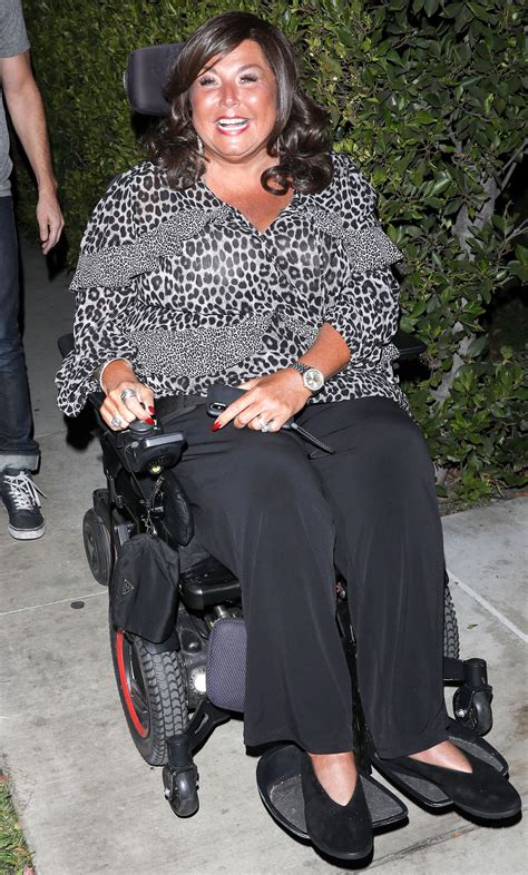 Abby Lee Miller Reveals Facelift Results See The Before And After Photos Arkhealthandselfreliance