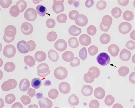 Nucleated Red Blood Cells And Lymphocytes Eclinpath