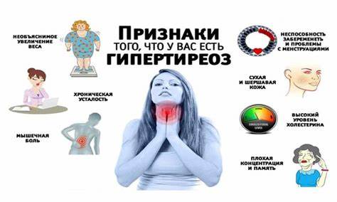 Диета и гипертиреоз Гипертиреоз: причины развития, симптомы, лечение и диета Гипертиреоз: причины развития, симптомы, лечение и диета Диета и гипертиреоз