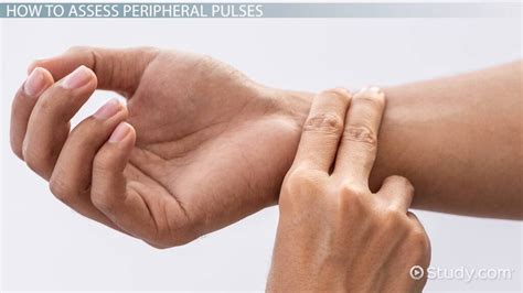 Peripheral Pulses Location Assessment And Importance Video And Lesson