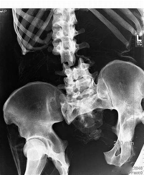 The Weirdest X Rays Ever 20 Pics