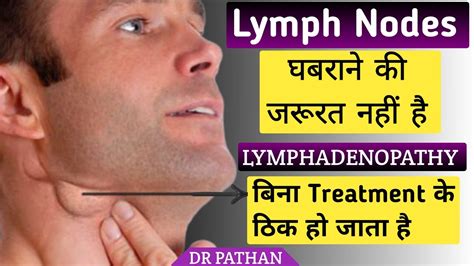 Lymph Nodes क्या है L Lymphadenopathy किसे कहते हैं L Lymphadenopathy