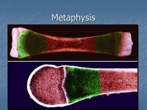 Ppt Bone Tissue Powerpoint Presentation Id6130412