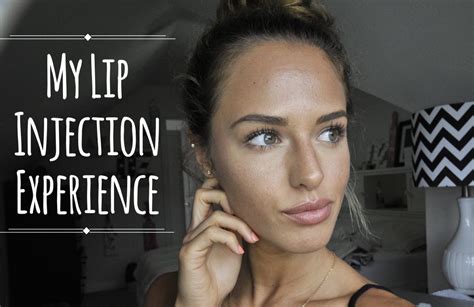 My Lip Injection Experience With Juvéderm Mackenzie Salmon Juvederm