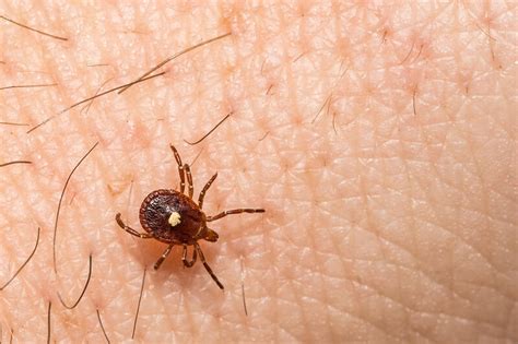 Ticks That Can Make You Allergic To Red Meat Are Becoming More Common