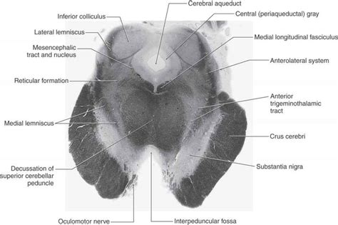 Not very descriptive with anatomy and hard to follow. The Midbrain | Neupsy Key
