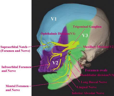 1 The Figure Shows The Location Of The Trigeminal Ganglion Foramen