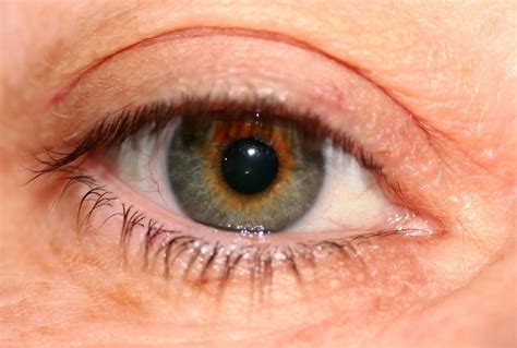 ¿sabes qué es el síndrome del ojo seco salud