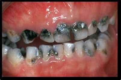 treatments sujays dental care