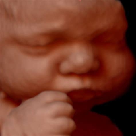 Video Image Gallery Mother Nurture Ultrasound My XXX Hot Girl