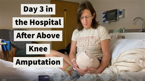 Above Knee Amputation Anatomy