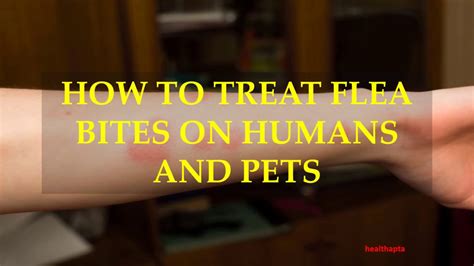 How To Treat Flea Bites On Humans And Pets Youtube