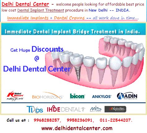 All On 6 - Full Mouth Teeth Implant Treatment Procedure in India ...