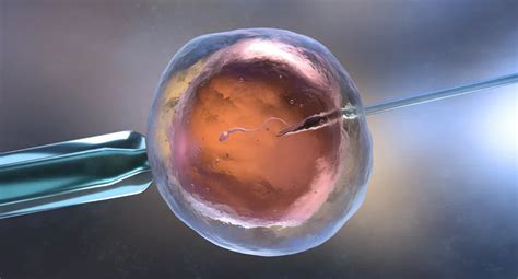 Fertility Doctor Human Understanding Is Key To Assisted Reproduction Success Prague Czech