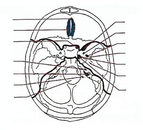 Schéma Foramens Base Du Crâne Partie 22 Diagram Quizlet