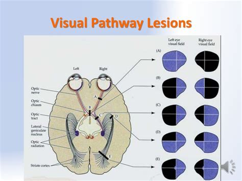 The Visual System