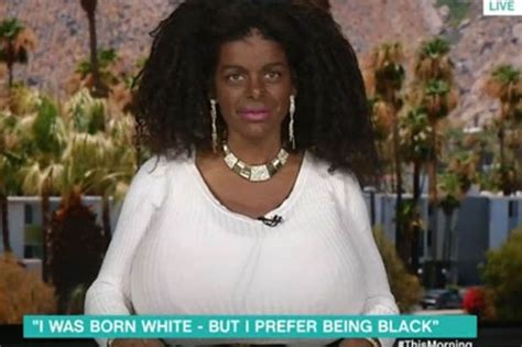 This Morning Martina Big Tanning Injections Make White Woman Identify
