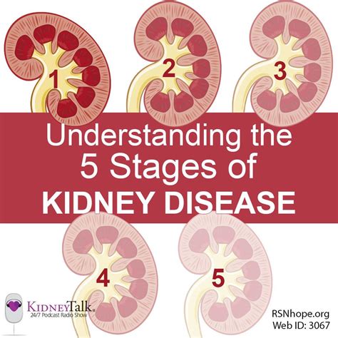 Understanding The Five Stages Of Kidney Disease Kidney Disease Stages