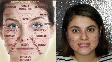 Face Mapping For Acne Face Map With Me Youtube