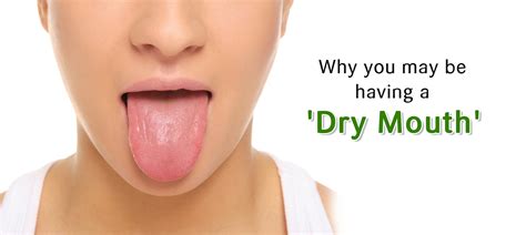 Dry Mouth Symptoms And Reasons Medplusmart