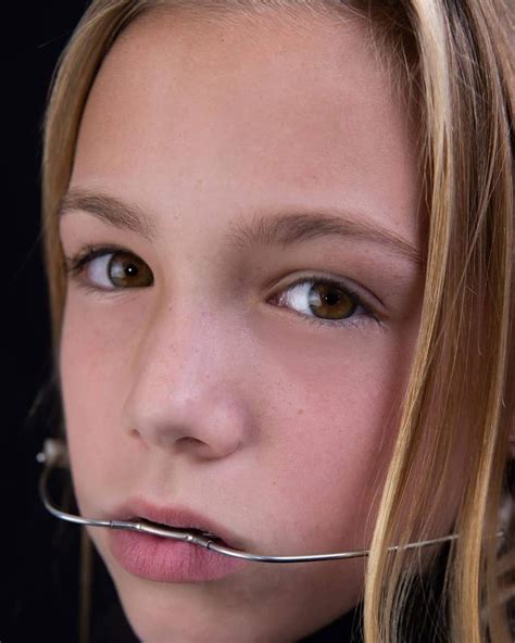 Pin By Kaleb Hughes On Orthodontic Headgear In 2020 Braces Girls