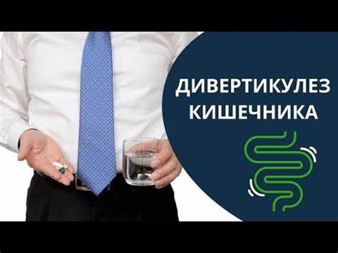 Диета дивертикулит кишечника Дивертикулез кишечника и дивертикулит. Сидит тихо, вызывает рак! - YouTube Дивертикулез кишечника и дивертикулит. Сидит тихо, вызывает рак! - YouTube Диета дивертикулит кишечника